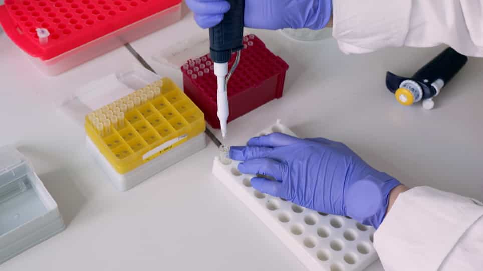 Determination of Glucan Chain Length Distribution of Glycogen Using the Fluorophore-Assisted Carbohydrate Electrophoresis FACE Method