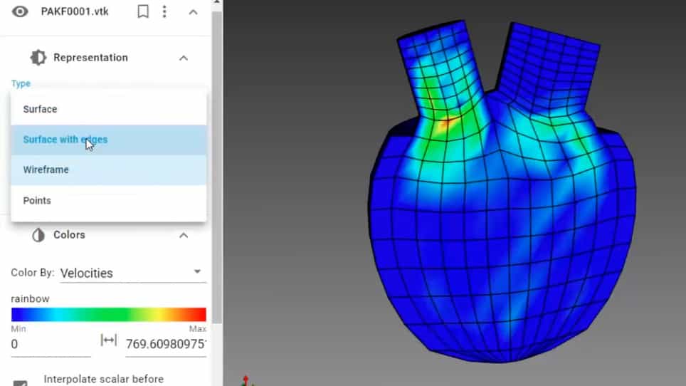 In Silico Clinical Trials for Cardiovascular Disease