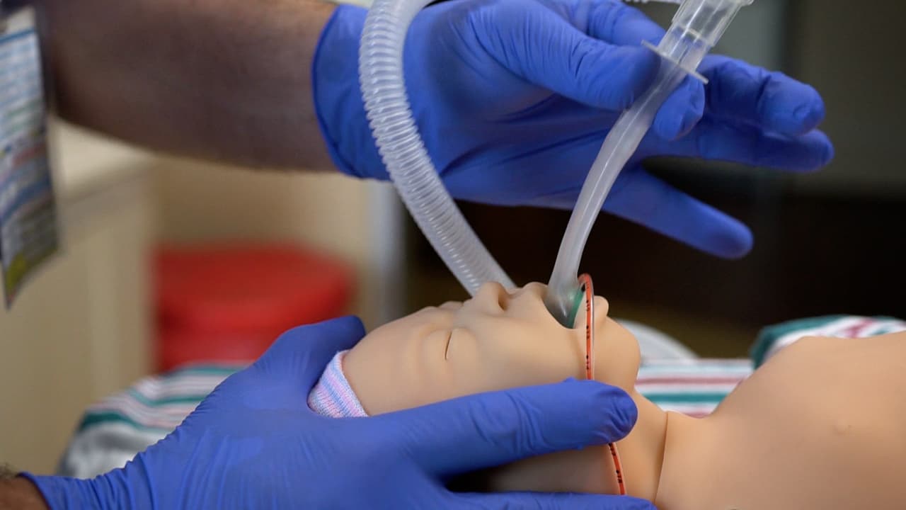 Laryngeal Mask Airway LMA Placement in a Neonatal Patient Simulator Using a Non-Inflatable Supraglottic Airway SGA
