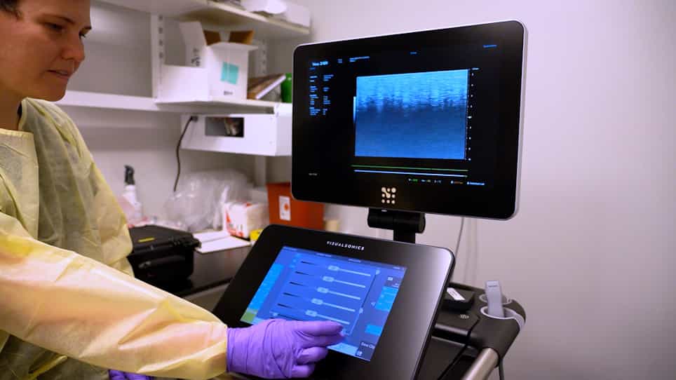 Non-Invasive Ultrasound Assessment of Endometrial Cancer Progression in Pax8-Directed Deletion of the Tumor Suppressors Arid1a and Pten in Mice