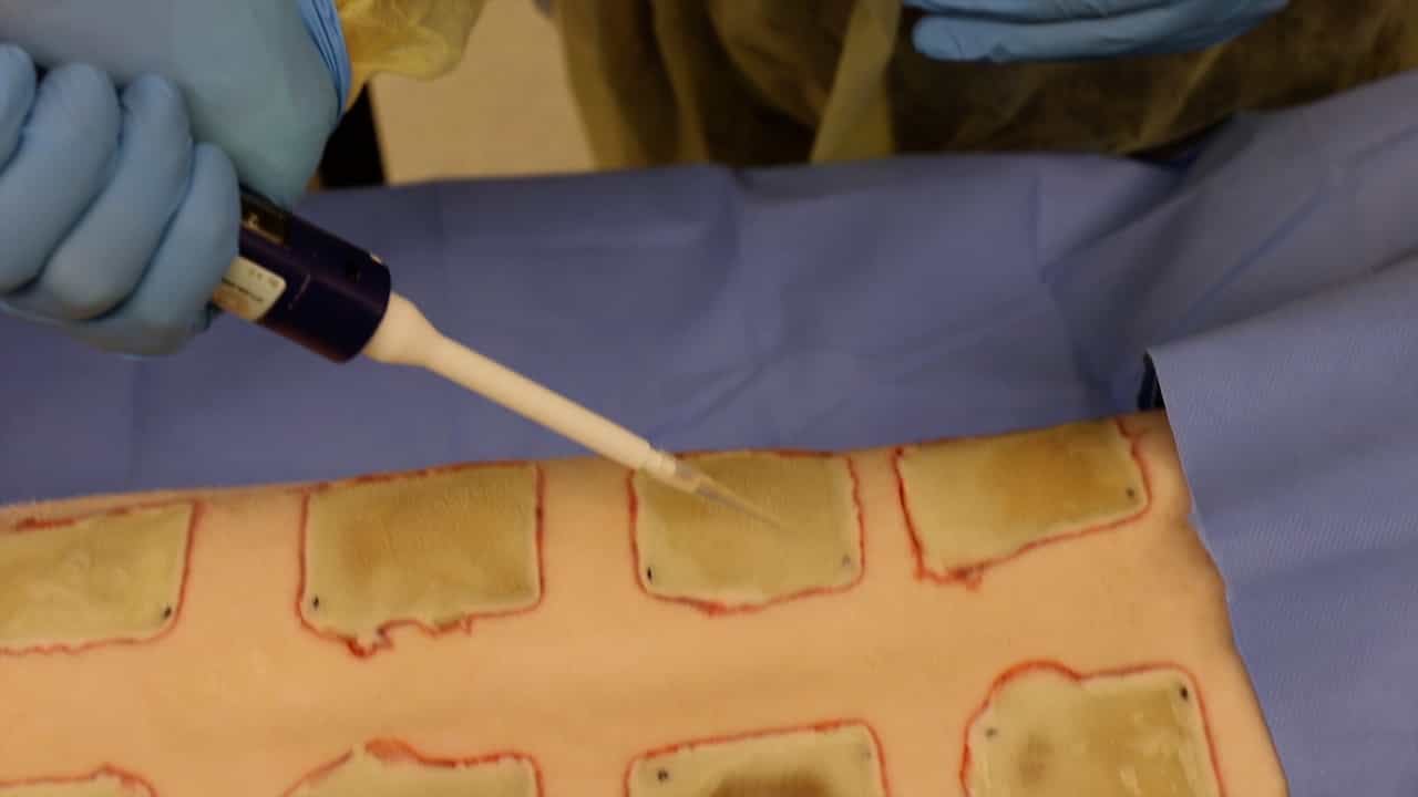 Author Spotlight: Studying Host-Microbe Interactions in Wound Biofilm Formation