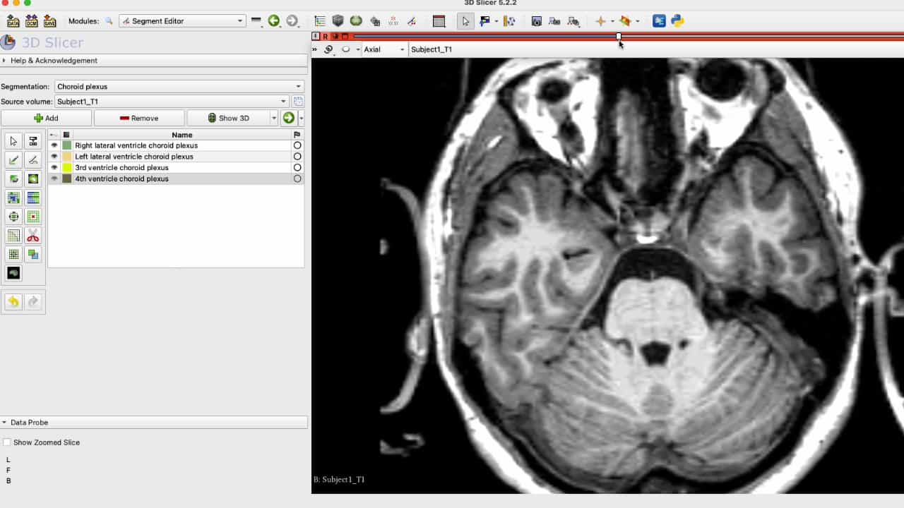Author Spotlight: Bridging Gaps in Anatomy and Establishing a Foundation for Algorithmic Studies