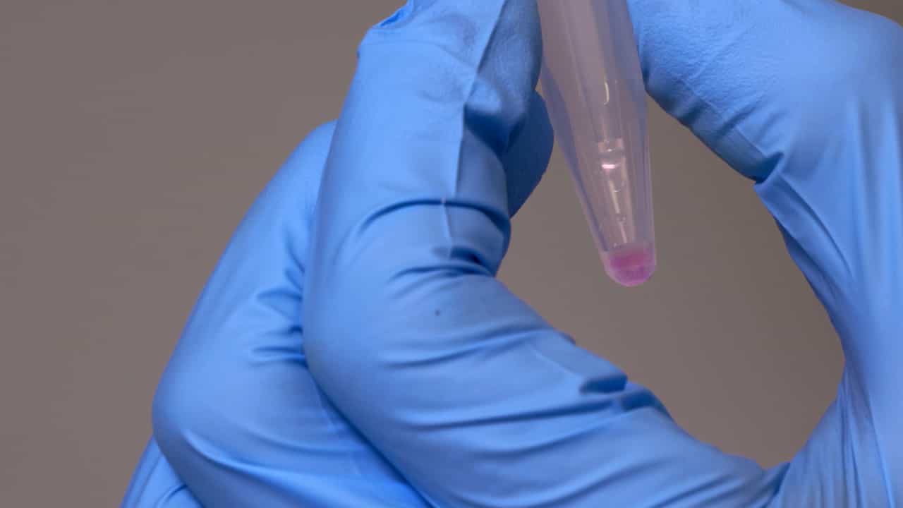 Author Spotlight: Whole-Mount Fluorescence In Situ Hybridization to Study Spermatogenesis in the Anopheles Mosquito
