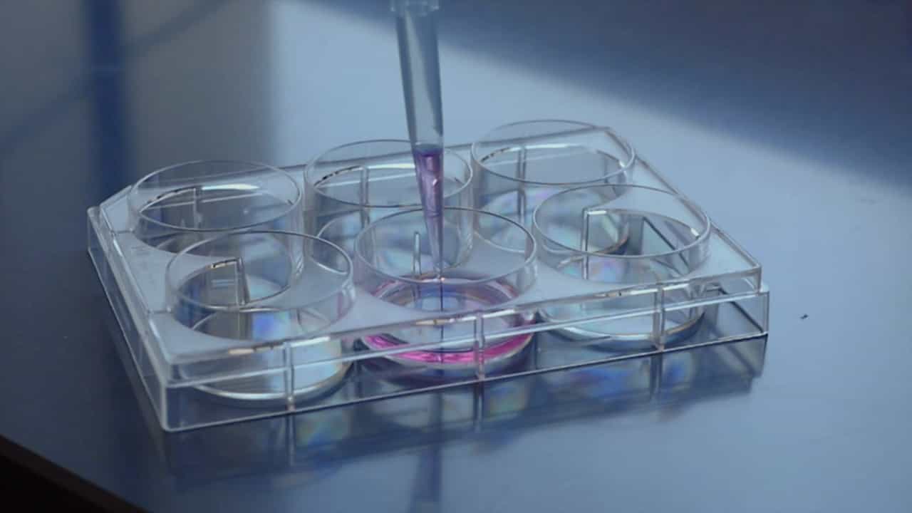 Optimizing Mouse Primary Lens Epithelial Cell Culture: A Comprehensive Guide to Trypsinization