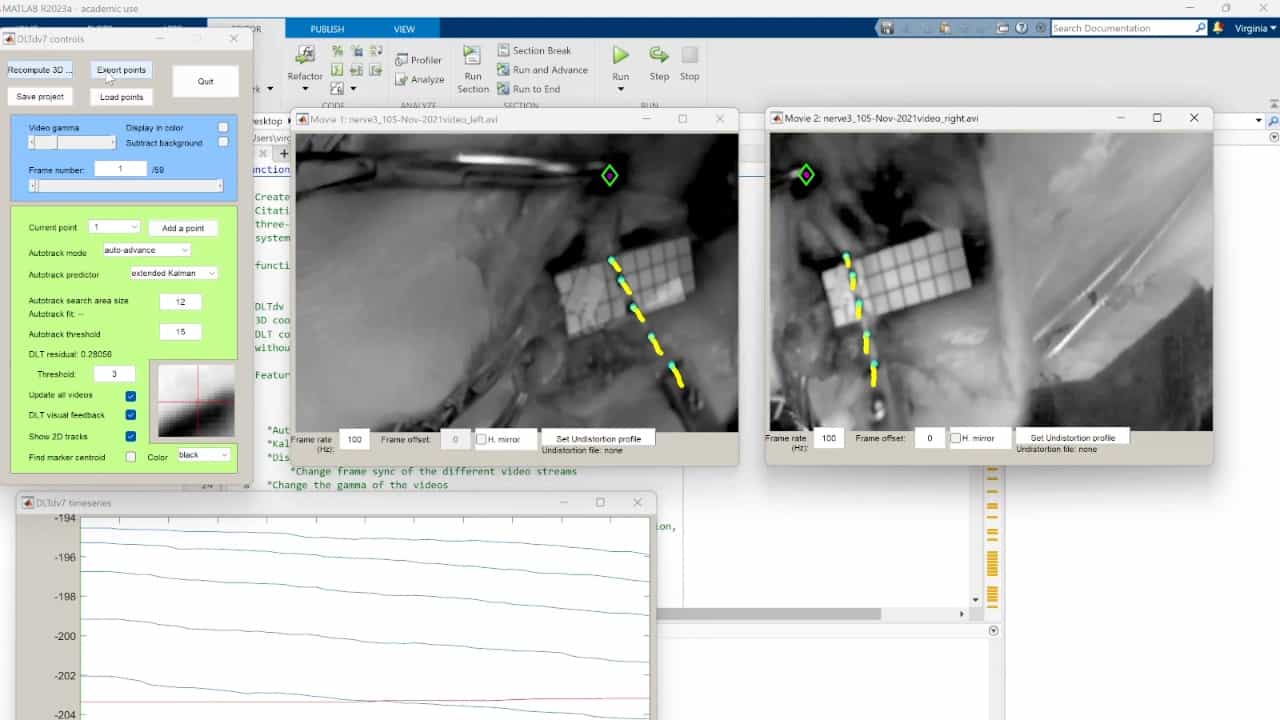 Stereo-Imaging System DLT Calibration to Capture 3D In Situ Displacements of Stretched Peripheral Nerves