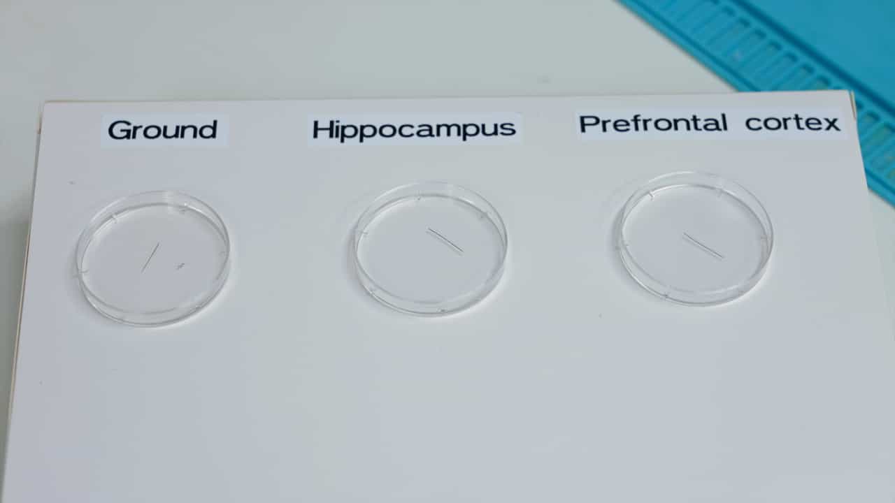 Author Spotlight: Studying Drug Impacts on Brain Signals Using Dual LFP Recording Protocol in Mice