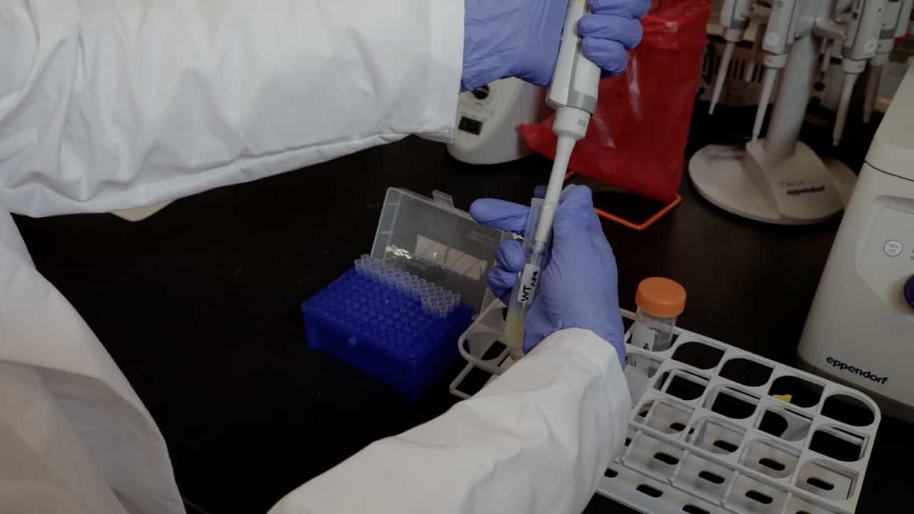 Epithelial Cell Infection Analyses with Shigella