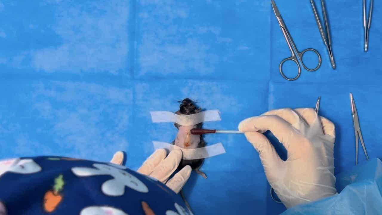 Mouse Wound Models and Preparation of Single-Cell Suspensions