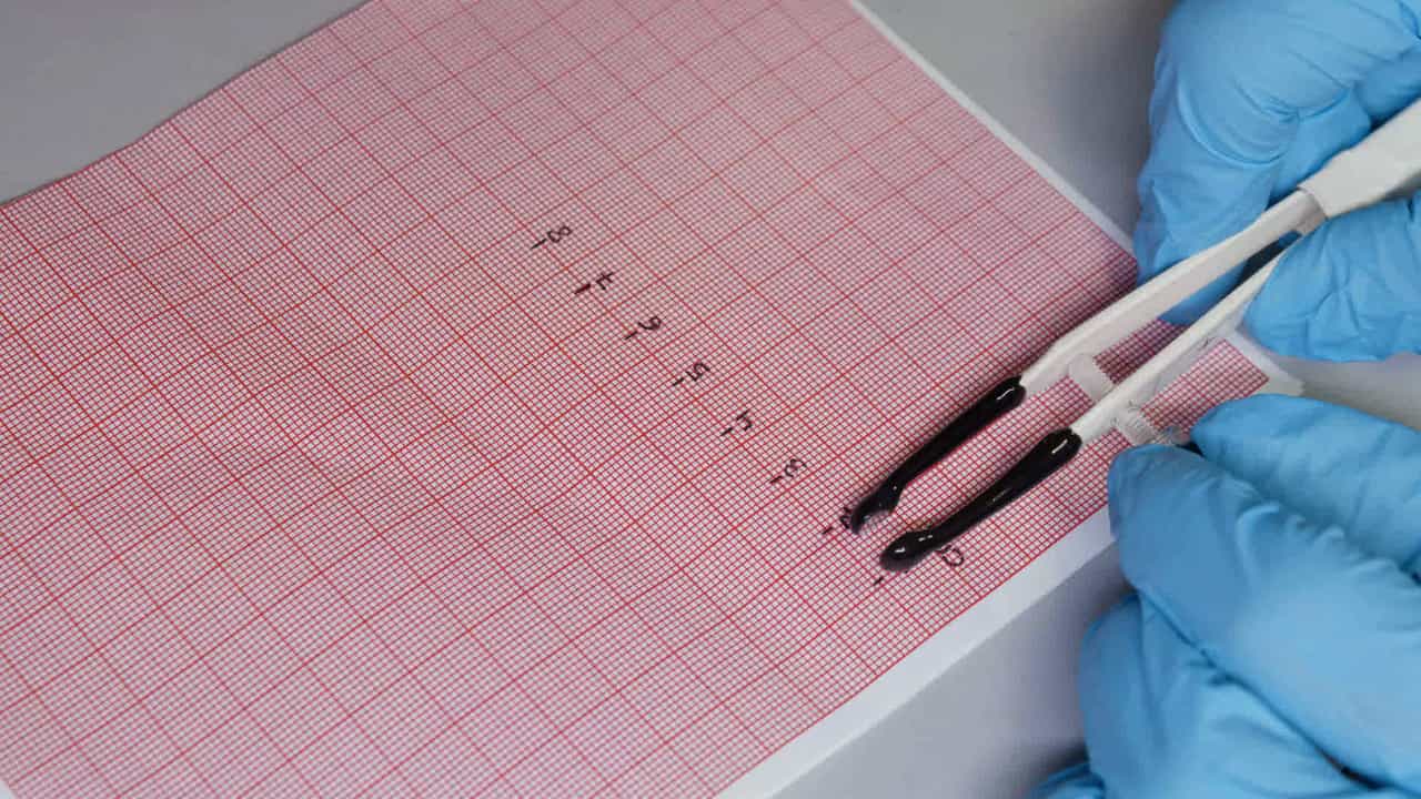 Author Spotlight: Cardiac Cell Transgenesis for Rapid Gene Screening