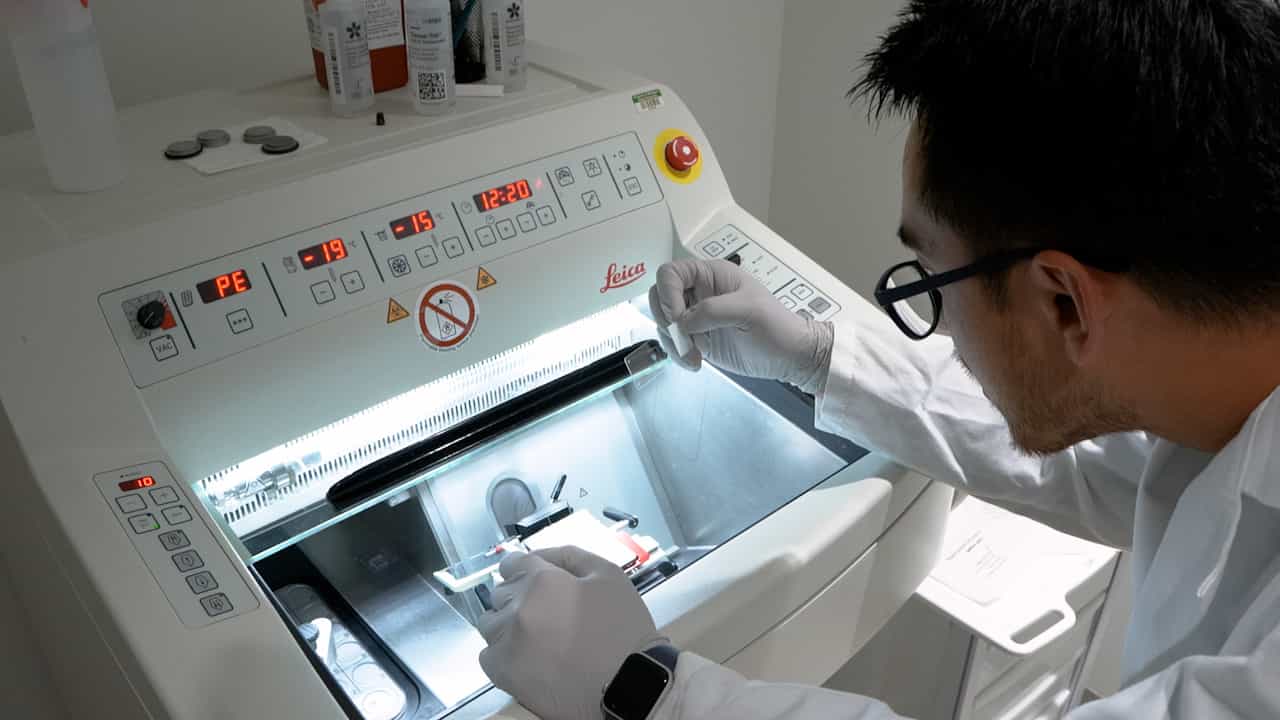 Monitoring of Nanodrug Accumulation in Murine Breast Cancer Metastases