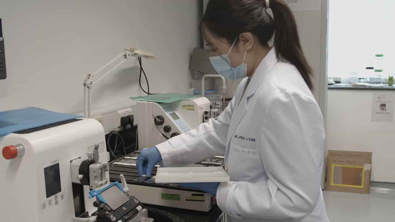 Author Spotlight: Multiplex Immunohistochemistry for Understanding Immune Regulation by Uterine NK Cells in Pregnancy