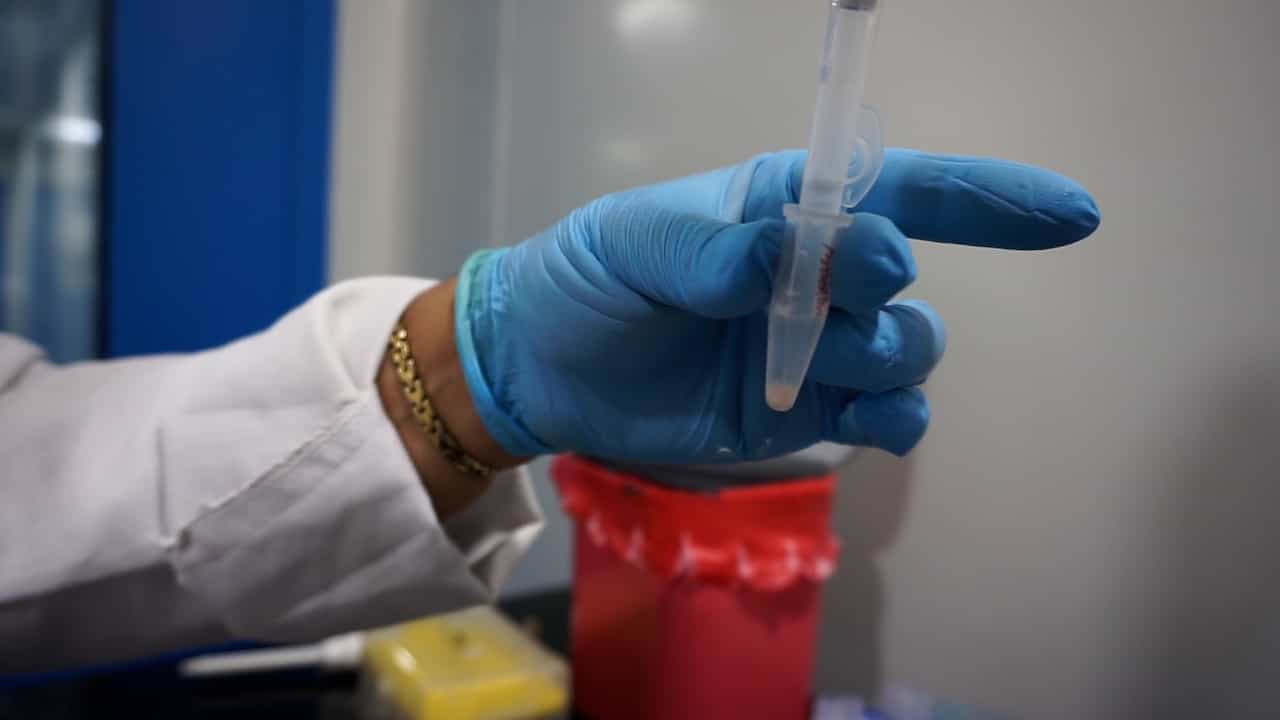 Enriching Subcellular Proteins in Leptospira Using a Triton X-114-Based Fractionation Approach