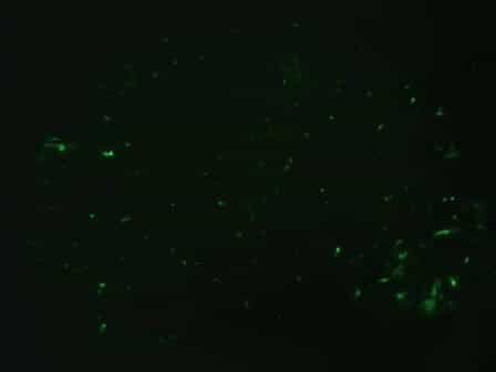 Preparation of Gene Gun Bullets and Biolistic Transfection of Neurons in Slice Culture