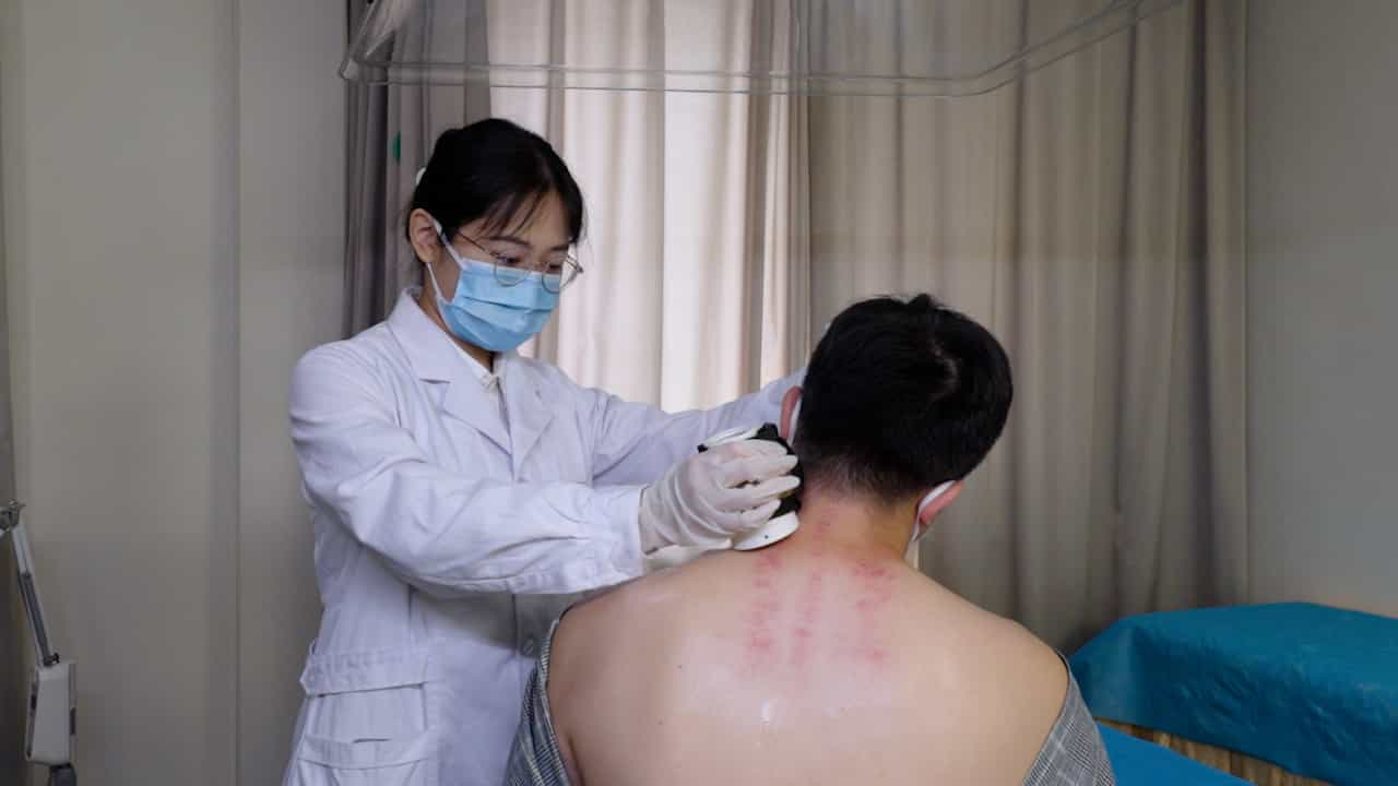 Warm Moxibustion and Scraping as a Traditional Chinese Medicine Therapy for Cervical Spondylosis Treatment