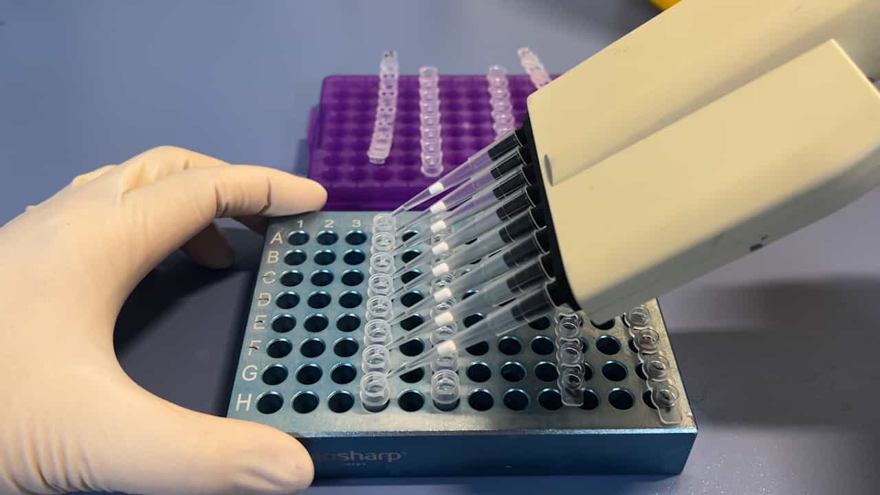 Identification of Mycobacterium Species by DNA Microarray Chip Method