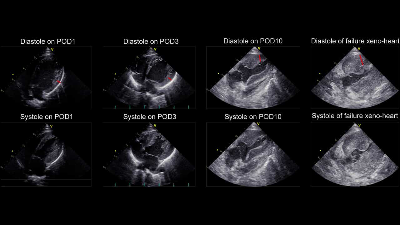 A Standardized Pig to Macaque Heterotopic Heart Xenotransplantation Model