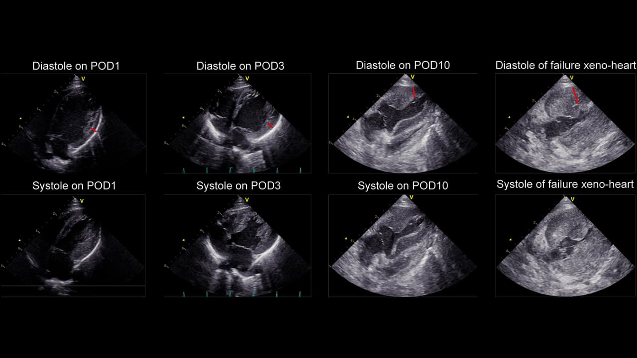 A Standardized Pig to Macaque Heterotopic Heart Xenotransplantation Model