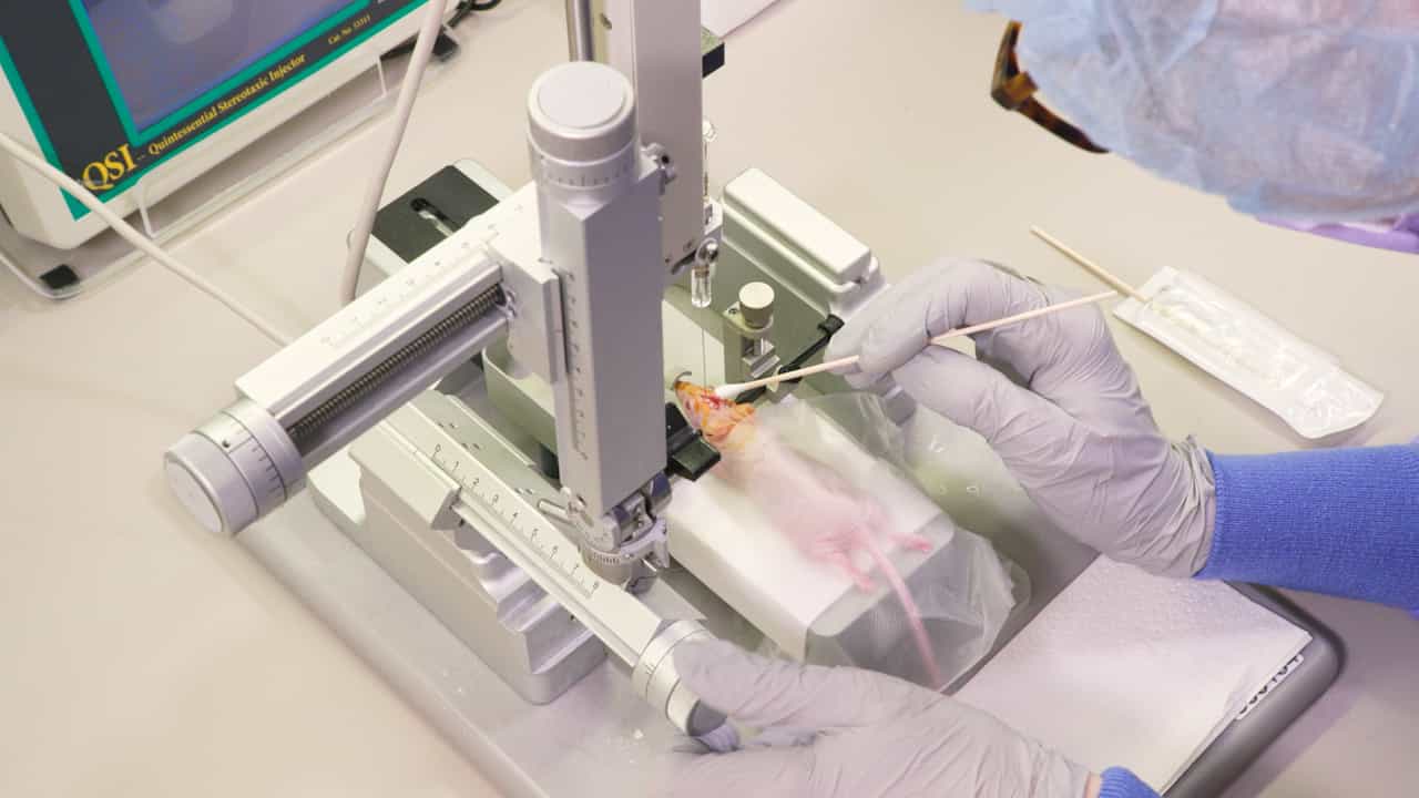Stereotactic Intracranial Implantation of Glioblastoma Patient-derived Xenograft Cell Lines in Mice