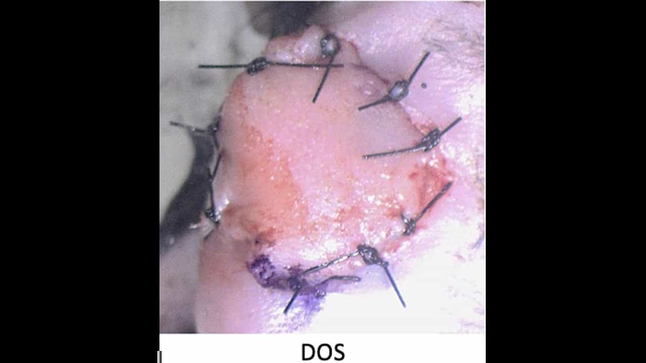 Heterotopic Hindlimb-to-Neck Transplantation in the Mouse: A Supermicrosurgical Model of Vascularized Composite Allotransplantation
