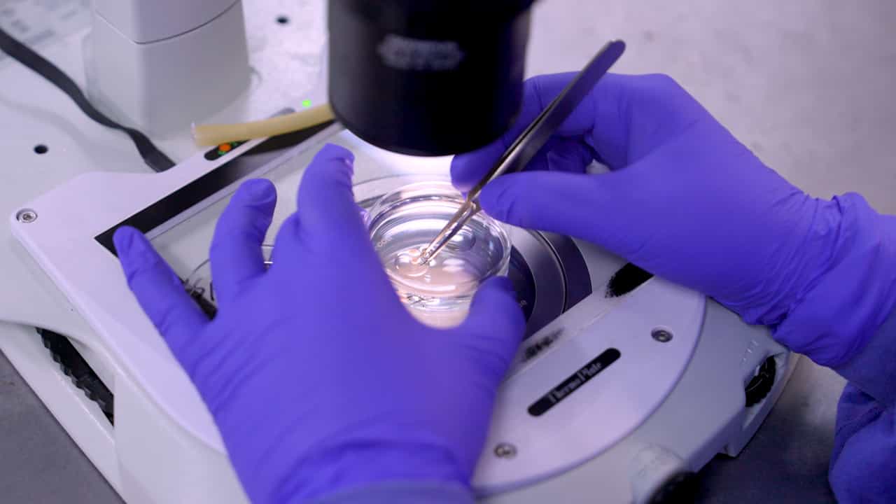 Mouse Oocyte In Vitro Maturation, Fertilization, and Culture of Preimplantation Embryos