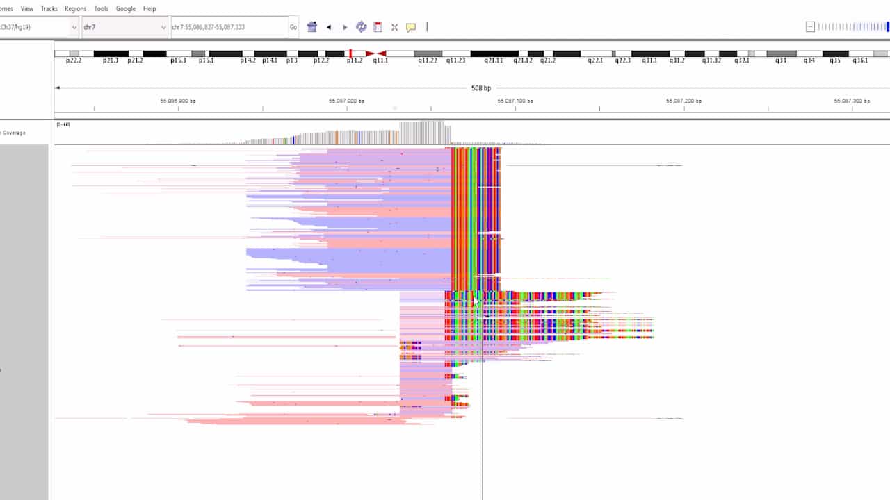 Clinical Variant Interpretation with the Integrative Genomics Viewer (IGV) for Molecular Pathologists
